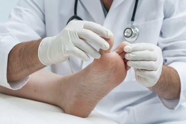 diagnostyka grzybicy stóp przez lekarza