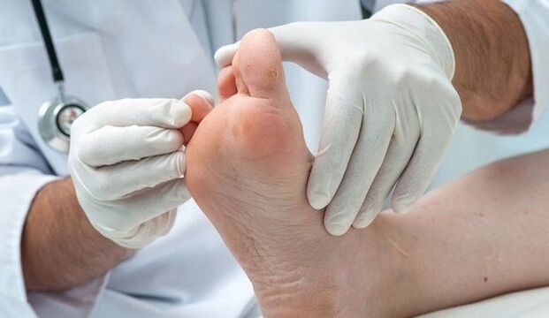 leczenie i diagnostyka grzybów przez lekarza