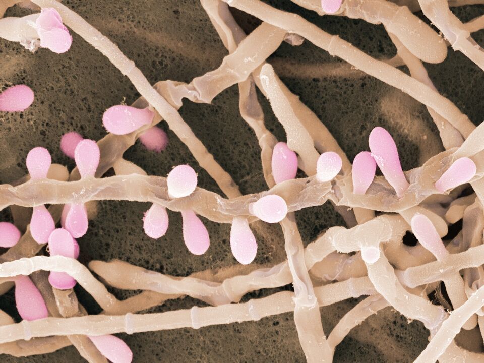 Trichophyton rubrum to rodzaj grzyba atakującego skórę stóp.